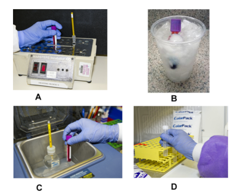    Which image represents the proper handling of specimens for cold agglutinins? (check all that apply)  A)  Images A, B B)  Images B, D C)  Images A, C D)  Images D, A 