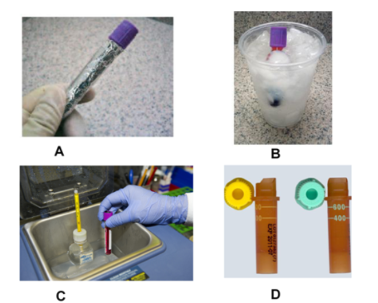    Which image represents the proper handling of specimens for bilirubin testing? (check all that apply)  A)  Images C, B B)  Images B, D C)  Images A, C D)  Images A, D 