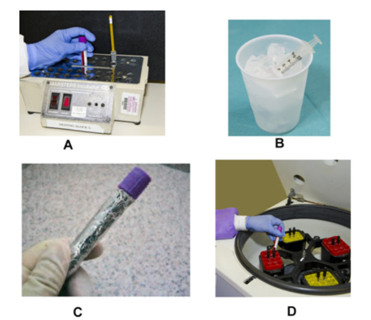    Which image represents the proper handling of specimens for blood gasses? (check all that apply)  A)  Image A B)  Image B C)  Image C D)  Image D 