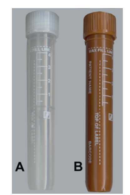    You are processing a light sensitive specimen to send out to a reference laboratory. Which image represents the most appropriate primary container? A)  Image A B)  Image B 