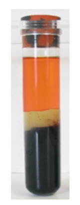    The specimen in this image needs to be recollected because A)  it has an incorrect additive to blood ratio. B)  RBCs have been destroyed, releasing calcium and potassium. C)  coagulation proteins have been activated. D)  the patient may not have been fasting. 