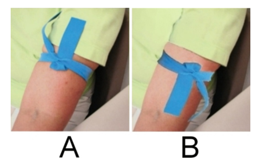    Which image provided shows the proper application of a tourniquet? A)  Image A B)  Image B C)  All of the above 
