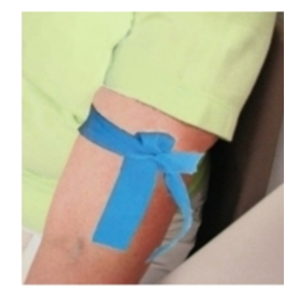    The application of the tourniquet in this image will cause A)  awkward blood collection B)  hematoma formation C)  hemoconcentration D)  no problems during blood collection 