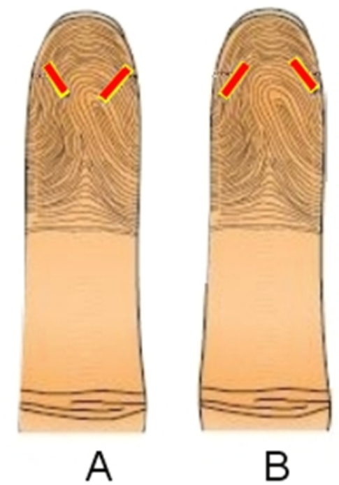 <strong>   -Which of the fingersticks, in this image, is performed correctly? (choose all that apply)</strong> A) Image A B) Image B C) All of the above <div style=padding-top: 35px> 