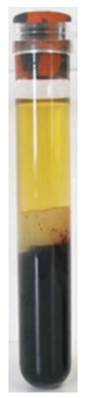 <strong>   -The specimen in this image was just removed from the centrifuge and appears</strong> A) hemolyzed B) icteric C) lipemic D) normal <div style=padding-top: 35px> 