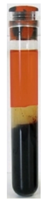 <strong>  The specimen in this image was just removed from the centrifuge and appears</strong> A) hemolyzed B) icteric C) lipemic D) normal <div style=padding-top: 35px> 