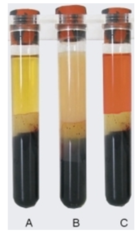 <strong>   -Which specimen in this image indicates that the patient was not fasting?</strong> A) Image A B) Image B C) Image C <div style=padding-top: 35px> 
