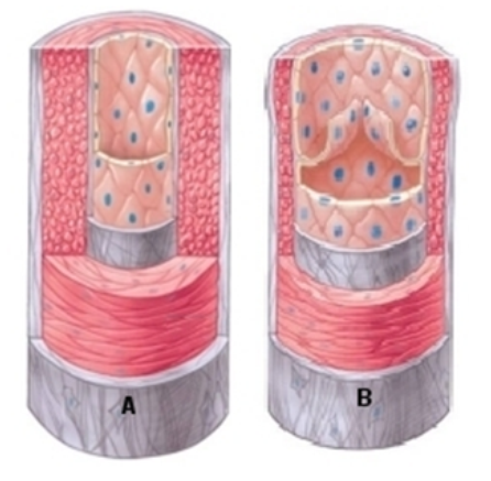   -The blood vessel in this image that is labeled  A is a(an)  A)  artery B)  capillary C)  vein 