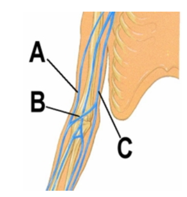 <strong>   -The blood vessel labeled Ais the</strong> A) basilic vein B) cephalic vein C) medican cubital vein <div style=padding-top: 35px> 