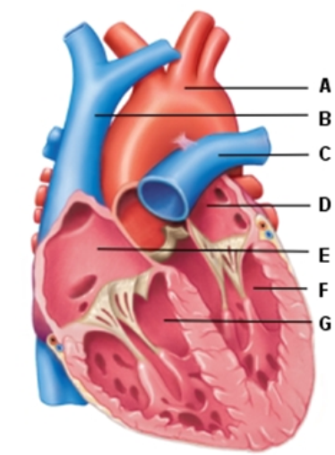 <strong>   -The structure in this image labeled Ais the</strong> A) aorta B) pulmonary artery C) pulmonary vein D) superior vena cava <div style=padding-top: 35px> 