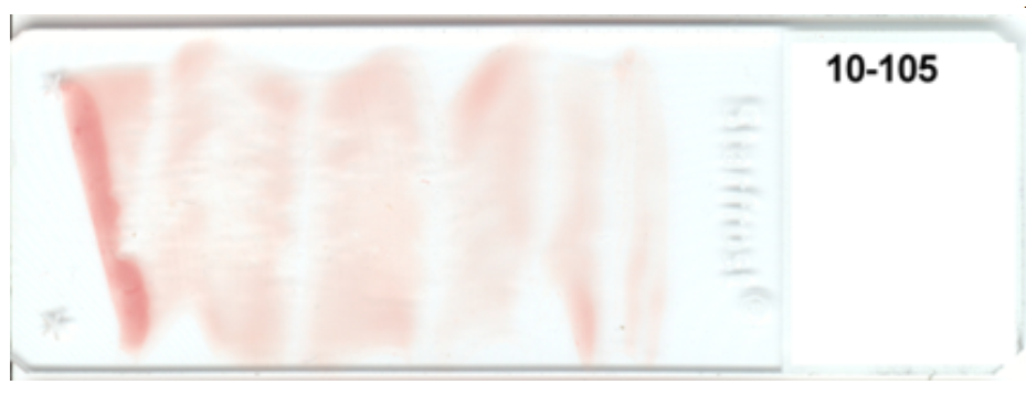   -The appearance of this blood smear is caused by using (check all that apply)  A)  a slide with fingerprints on it B)  unequal pressure on the spreader slide C)  a chipped slide for the spreader slide D)  a start and stop motion 