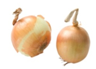 Identify the vegetable shown in the picture.   A)  Celery root B)  Kohlrabi C)  Yellow onions D)  Jicama