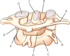 The structure transverse process is labeled _____.   