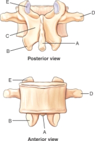 Which labeled structure is the pars interarticularis?   A)  A B)  B C)  C D)  D E)  E