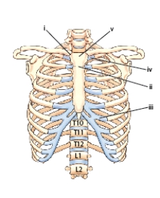 What is the name of the part labeled ii?   A)  Xiphoid process B)  Body C)  Sternoclavicular joint D)  Sternal angle