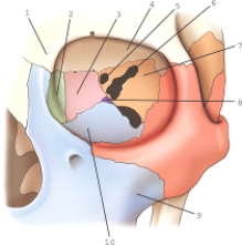 Part 3 is part of which bone?   A)  Palatine B)  Sphenoid C)  Lacrimal D)  Ethmoid