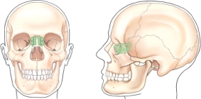 Which group of sinuses is shaded (screened) in the frontal and lateral views of the illustration below?   A)  Maxillary B)  Sphenoid C)  Ethmoid D)  Frontal