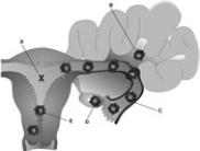 <strong> ________ Usual site of implantation</strong> A) A B) B C) C D) D E) E