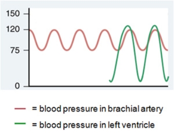 <strong>The brachial artery is the major artery in your upper arm. The figure below shows the blood pressure in the brachial artery of an average young adult, as it oscillates between the systolic pressure (120 mm Hg) and the diastolic pressure (75 mm Hg).   Superimposed on the right side of the graph is a tracing of the pressure in the left ventricle, which drops to close to zero mm Hg during diastole. What prevents the blood pressure in the brachial artery from similarly dropping to almost zero during diastole?</strong> A) Forceful closing of valves in the subclavian and brachial arteries propels the blood forward during diastole. B) Recoil of elastic fibers in the aorta propels the blood forward during diastole. C) Forceful closing of the aortic semilunar valve propels the blood forward during diastole. D) Rhythmic contraction of smooth muscle tissue in the subclavian and brachial arteries propels the blood forward during diastole. E) Inhaling and exhaling propels the blood forward during diastole. <div style=padding-top: 35px> 