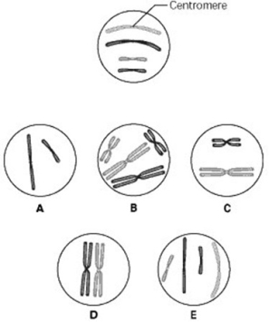 Use the figure to answer the question below. The unlettered circle at the top of the figure shows a diploid nucleus with four chromosomes that have not yet replicated. There are two pairs of homologous chromosomes, one long and the other short. One haploid set is black, and the other is gray. The circles labeled A to E show various combinations of these chromosomes.   What is the correct chromosomal condition at prometaphase of mitosis? A)  B B)  C C)  D D)  E 