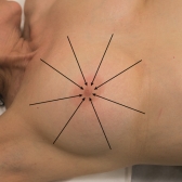 <strong>  In the accompanying figure, what is the breast palpation technique pattern for assessing the breasts?</strong> A) Vertical strip pattern B) Radial spoke pattern C) Circular pattern D) Bimanual pattern <div style=padding-top: 35px> 