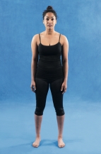   You are performing an assessment of the vertebrae and assess the posture shown in the accompanying figure. What type of posture do you see in the picture? A)  Lordosis B)  Scoliosis C)  Kyphosis D)  Normal posture 