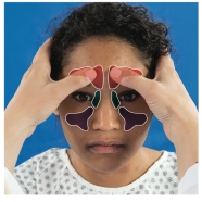 <strong>  What are you assessing in the picture above?</strong> A) Sphenoid sinuses B) Frontal sinuses C) Maxillary sinuses D) Ethmoid sinuses <div style=padding-top: 35px> 