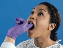 <strong>  You are assessing the mouth of this patient. What technique are you performing?</strong> A) Inspecting the upper dentition B) Inspecting and palpating the dorsal surface of the tongue C) Palpating the soft and hard palates D) Inspecting and palpating the soft palate only <div style=padding-top: 35px> 