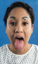 <strong>  You are performing a mouth assessment. What are you assessing in this picture?</strong> A) Mouth range of motion B) Jaw range of motion C) Dorsal surface of the tongue D) Ventral surface of the tongue <div style=padding-top: 35px> 
