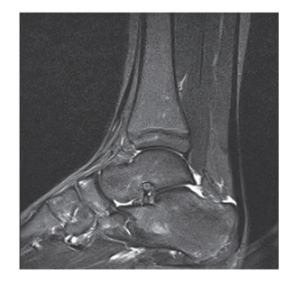   -Refer to the figure. Identify the image. A)  Sagittal T1-weighted MRI B)  Sagittal T2-weighted MRI C)  Coronal T1-weighted MRI D)  Coronal T2-weighted MRI