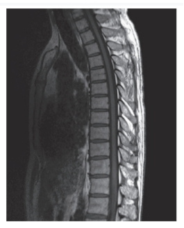 <strong>   -Refer to the figure. What imaging modality and view is this?</strong> A) Lateral radiograph B) Sagittal CT C) Coronal MRI D) Sagittal MRI <div style=padding-top: 35px> 