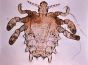 Name the arthropod shown in the following image:   A)  Cimex lectularius B)  Pediculus humanus capitis C)  Pediculus humanus humanus D)  Phthirus pubis