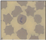 Name the parasite shown in the following image:   A)  Babesia microti B)  Plasmodium falciparum C)  Plasmodium malariae D)  Plasmodium vivax