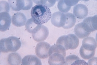 Name the parasite shown in the following image:   A)  Plasmodium falciparum B)  Plasmodium malariae C)  Plasmodium ovale D)  Plasmodium vivax