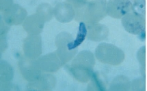 Name the parasite shown in the following image:   A)  Plasmodium falciparum B)  Plasmodium malariae C)  Plasmodium ovale D)  Plasmodium vivax