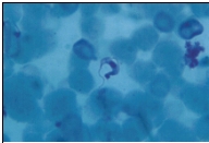 Name the parasite shown in the following image:   A)  Plasmodium falciparum B)  Trypanosoma brucei rhodiense C)  Trypanosoma brucei gambiense D)  Trypanosoma cruzi