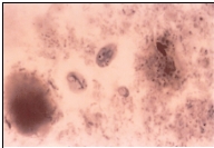 Name the parasite shown in the following image:   A)  Chilomastix mesnili B)  Enteromonas hominis C)  Giardia lamblia D)  Trichomonas vaginalis