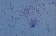Name the parasite shown in the following image:   A)  Chilomastix mesnili B)  Enteromonas hominis C)  Giardia lamblia D)  Trichomonas vaginalis