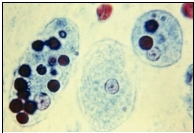 Name the parasite shown in the following image:   A)  Entamoeba coli B)  Entamoeba dispar C)  Entamoeba hartmanni D)  Entamoeba histolytica