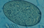 <strong>Name the parasite shown in the following image: </strong> A) Clonorchis sinensis B) Diphyllobothrium latum C) Fasciola hepatica D) Paragonimus westermani