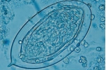 <strong>Name the parasite shown in the following image: </strong> A) Clonorchis sinensis B) Schistosoma haematobium C) Schistosoma japonicum D) Schistosoma mansoni
