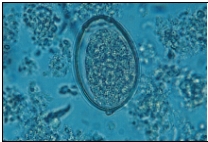 <strong>Identify the parasite shown in the following view: </strong> A) Diphyllobothrium latum B) Echinococcus granulosa C) Hymenolepis nana D) Taenia saginata