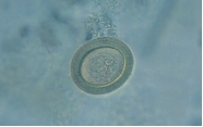 <strong>Identify the parasite shown in the following view: </strong> A) Ascaris lumbricoides B) Taenia saginata C) Taenia solium D) Either b or c E) None of these