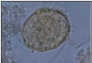 <strong>Name the parasite shown in the following image: </strong> A) Ascaris lumbricoides egg B) Enterobius vermicularis egg C) Hookworm egg D) Trichuris trichiura egg