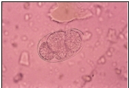 <strong>Name the parasite shown in the following image: </strong> A) Ascaris lumbricoides egg B) Enterobius vermicularis egg C) Hookworm egg D) Trichuris trichiura egg