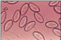 Name the parasite shown in the following image:   A)  Ascaris lumbricoides egg B)  Enterobius vermicularis egg C)  Hookworm egg D)  Trichuris trichiura egg