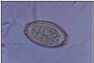 Name the parasite shown in the following image:   A)  Ascaris lumbricoides egg B)  Enterobius vermicularis egg C)  Hookworm egg D)  Trichuris trichiura egg