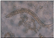 Name the parasite shown in the following image:   A)  Wuchereria bancrofti-microfilaria B)  Filariform larva C)  Pinworm-female D)  Rhabditiform larva