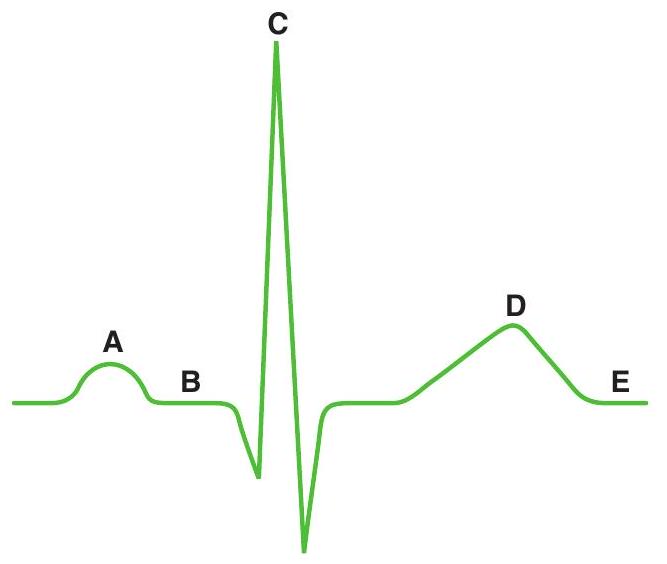  THE FOLLOWING DIAGRAM APPLIES TO THE FOLLOWING QUESTIONS    -During which labeled wave or segment of the electrocardiogram (ECG)  are both the atria and the ventricles completely repolarized? A)   \mathrm{A}  B)   \mathrm{B}  C)   \mathrm{C}  D)   \mathrm{D}  E)   \mathrm{E}
