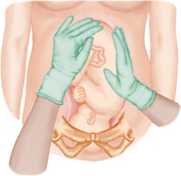 The nurse is performing Leopold's maneuvers on a client. Which figure depicts the Leopold's maneuver that determines whether the fetal presenting part is engaged in the maternal pelvis. Refer to Figures a to d A) B) C) D)